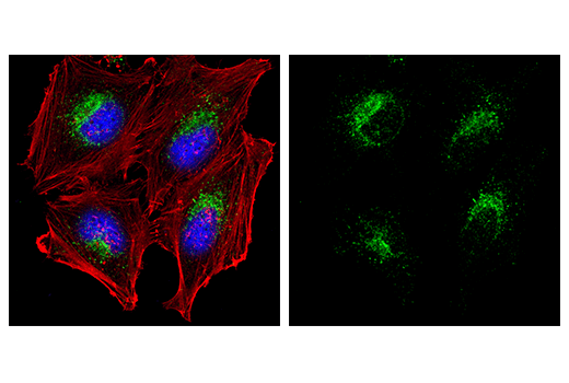 Immunofluorescence Image 1: LAMP1 (D2D11) XP<sup>®</sup> Rabbit mAb (Alexa Fluor<sup>®</sup> 488 Conjugate)