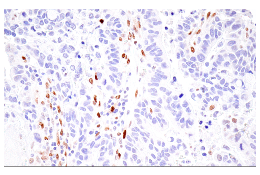 Immunohistochemistry Image 1: HIF-1α (E1V6A) Rabbit mAb