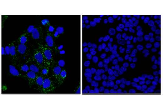 Immunofluorescence Image 1: LAMP3/CD208 (E6E5U) XP<sup>®</sup> Rabbit mAb (BSA and Azide Free)