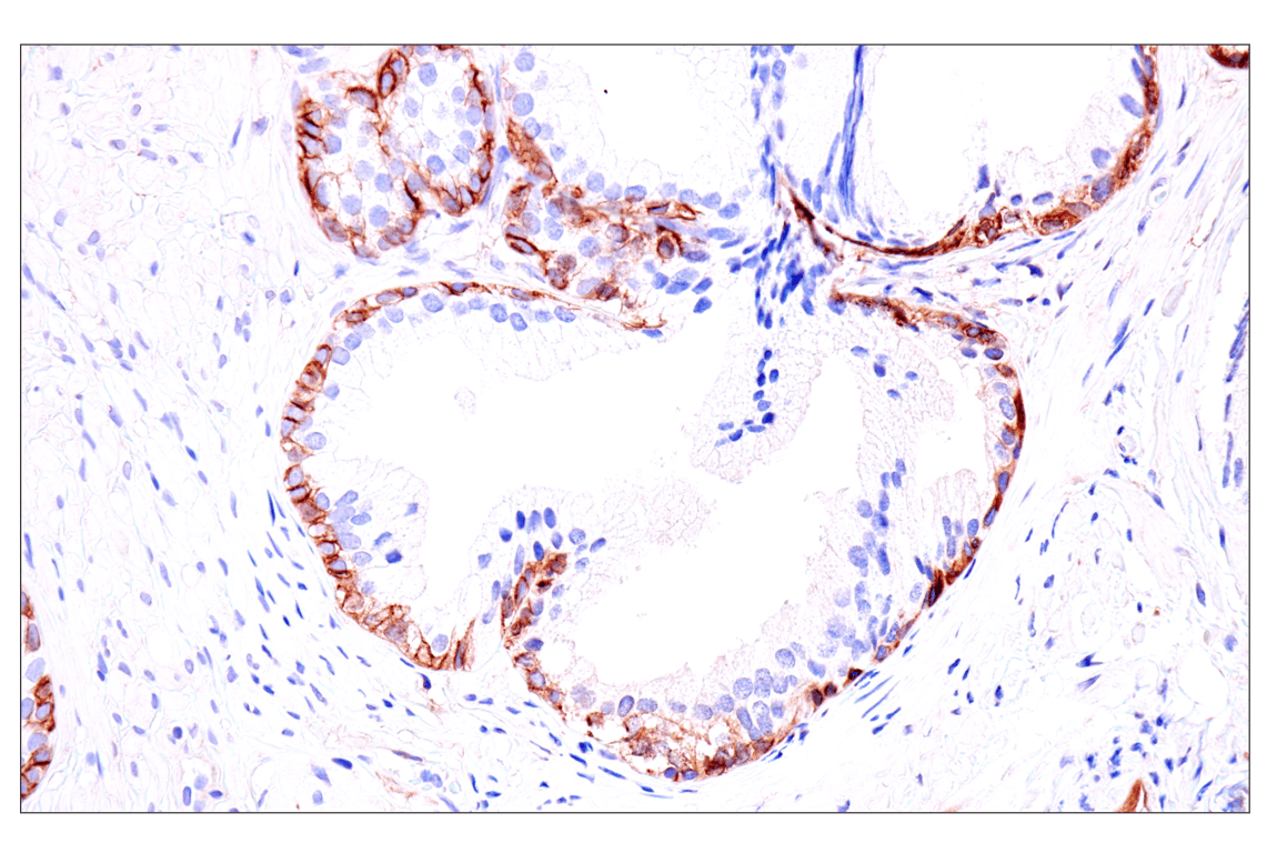 Immunohistochemistry Image 9: p75NTR (E7I3M) Rabbit mAb