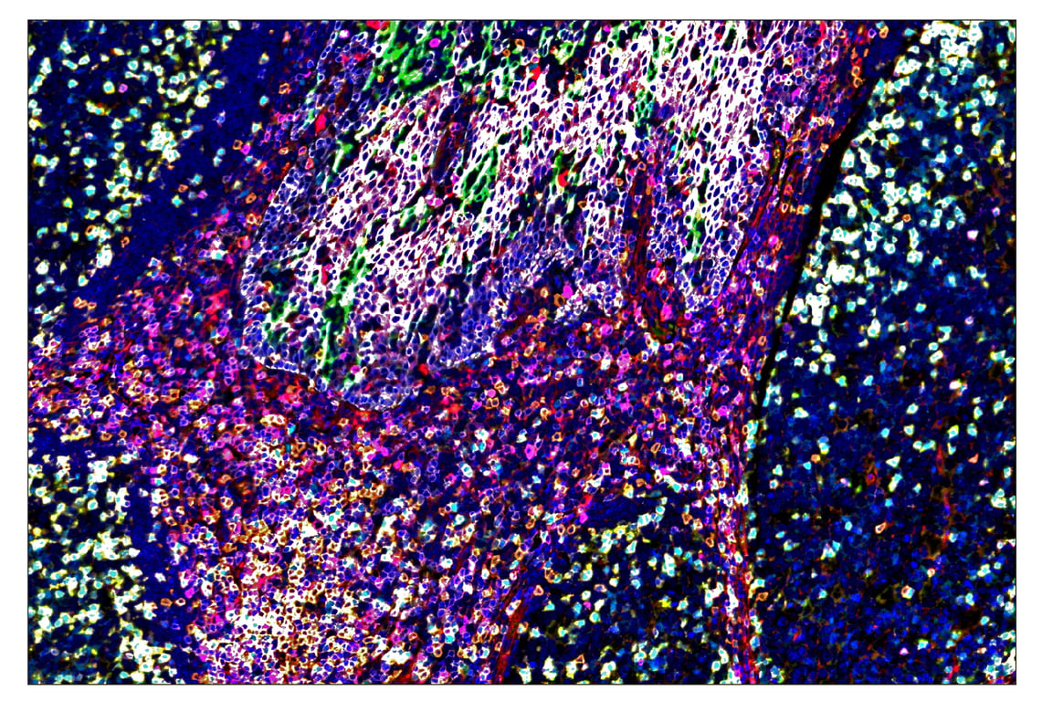 Immunohistochemistry Image 1: TIM-3 (D5D5R<sup>™</sup>) & CO-0010-594 SignalStar<sup>™</sup> Oligo-Antibody Pair