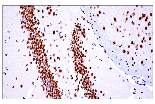 Immunohistochemistry Image 2: TDP43 (E2G6G) Rabbit mAb