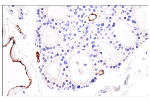 Immunohistochemistry Image 7: CD62P/P-Selectin (E8Q1W) XP<sup>®</sup> Rabbit mAb (BSA and Azide Free)