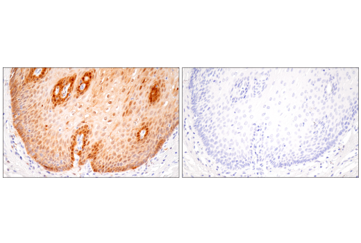 Immunohistochemistry Image 13: IL-18 (E3G8R) Rabbit mAb
