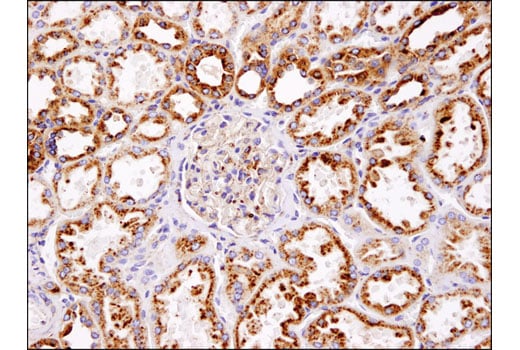 undefined Image 21: PICALM Signaling Antibody Sampler Kit