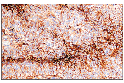 Immunohistochemistry Image 1: CD141/Thrombomodulin (E7Y9P) XP<sup>®</sup> Rabbit mAb (BSA and Azide Free)