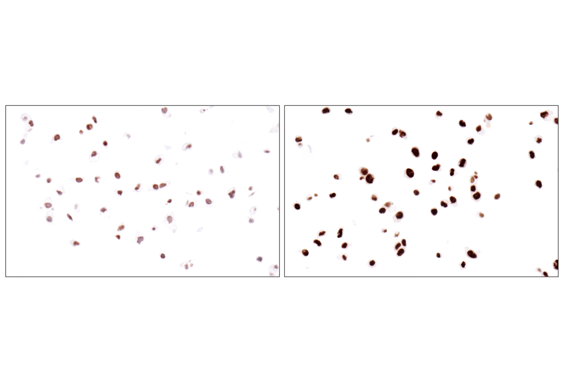 Immunohistochemistry Image 14: Acetyl-Histone H4 (Lys16) (E2B8W) Rabbit mAb