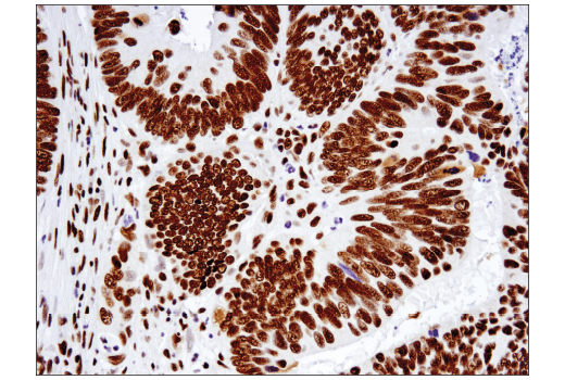 undefined Image 43: BAF Complex IHC Antibody Sampler Kit