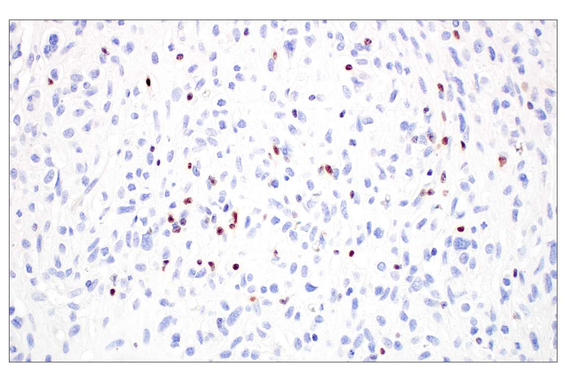 Immunohistochemistry Image 5: T-bet/TBX21 (E4I2K) Rabbit mAb