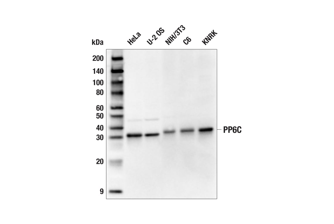 Western Blotting Image 1: PP6C (E3V2A) Rabbit mAb