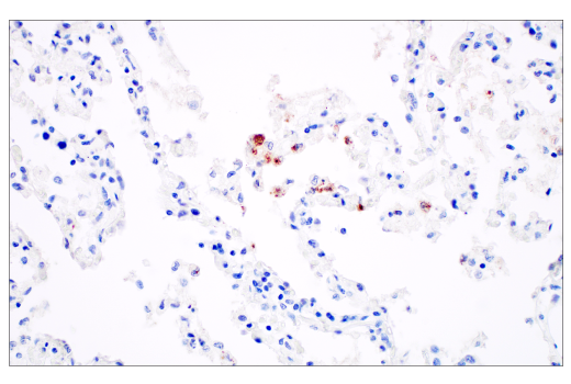 Immunohistochemistry Image 1: SARS-CoV-2 Nucleocapsid Protein (E9L7H) XP<sup>®</sup> Rabbit mAb