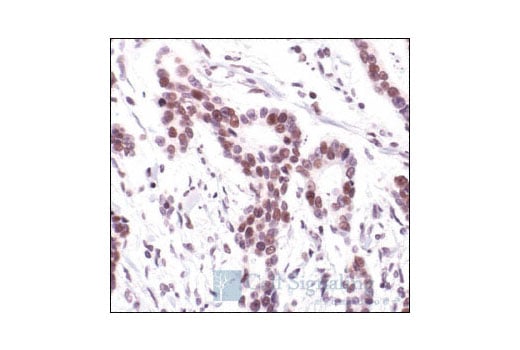 undefined Image 11: PhosphoPlus<sup>®</sup> c-Jun (Ser73) Antibody Duet