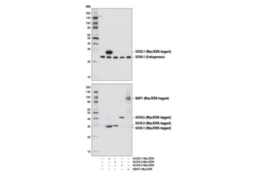 Western Blotting Image 2: UCHL1 (D8R2I) Rabbit mAb