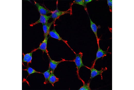 Immunofluorescence Image 1: Clathrin Heavy Chain (D3C6) XP<sup>®</sup> Rabbit mAb