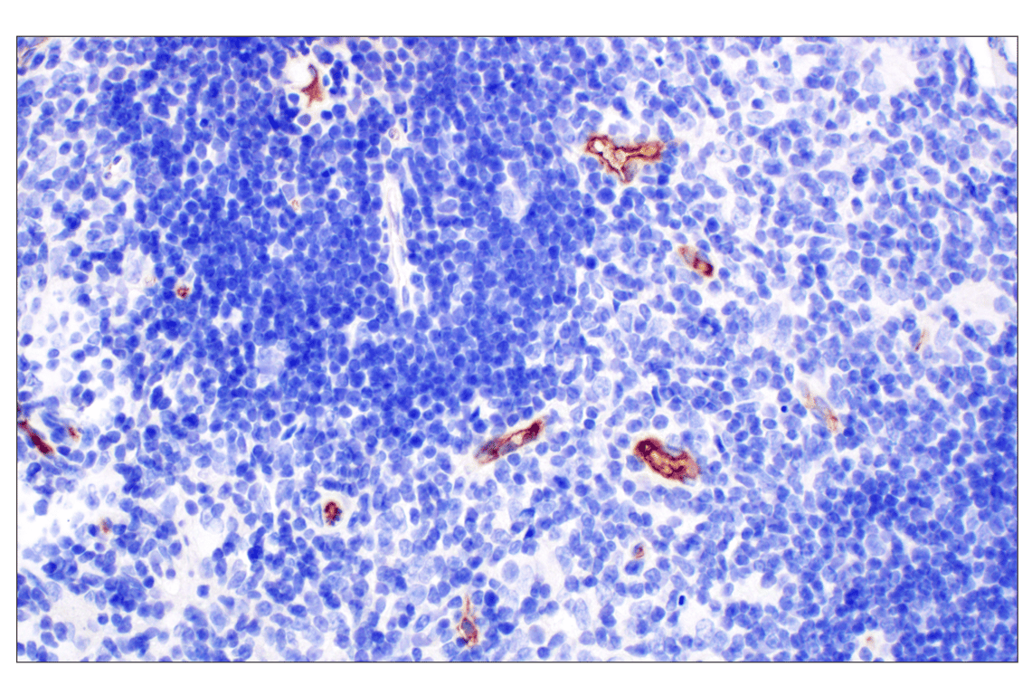 Immunohistochemistry Image 3: PNPLA3 (E7N6O) Rabbit mAb (BSA and Azide Free)