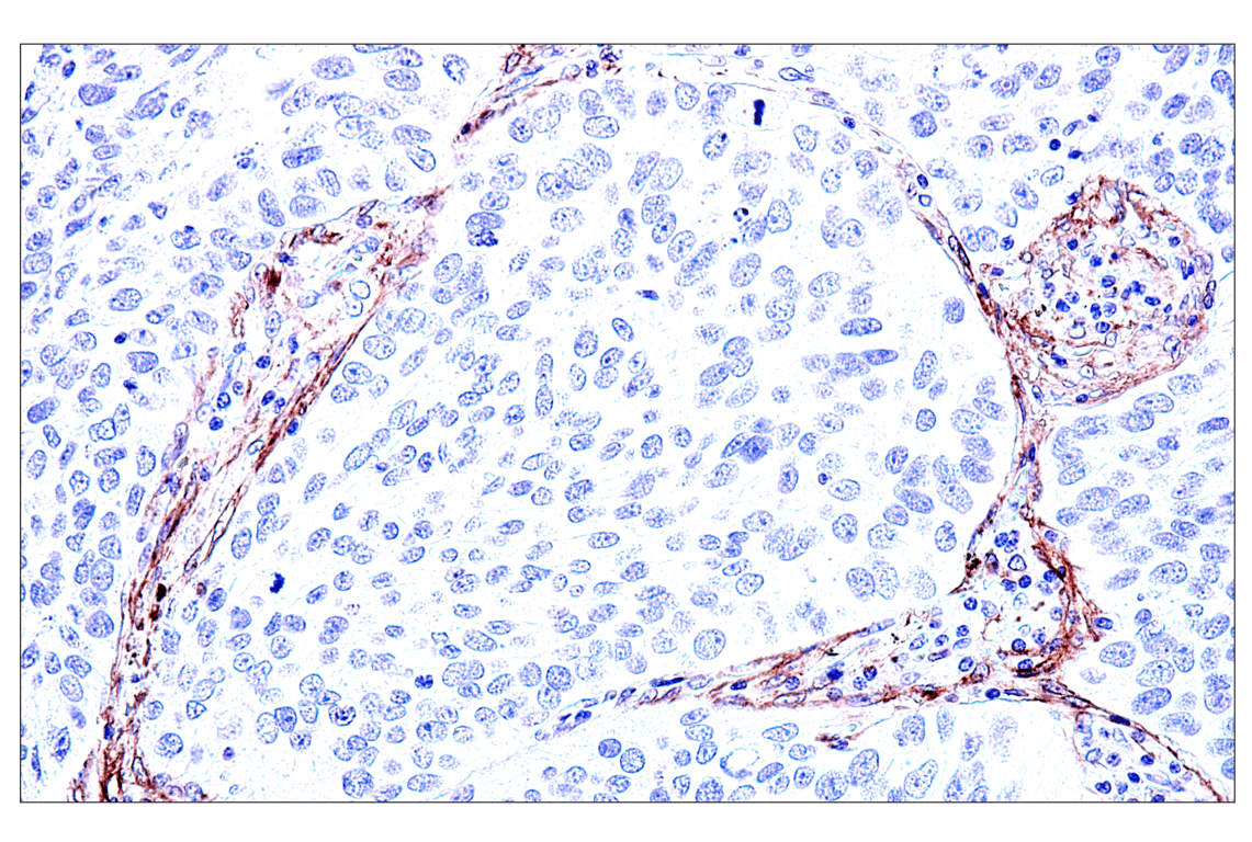 Immunohistochemistry Image 5: FAP (F1A4G) Rabbit mAb (BSA and Azide Free)