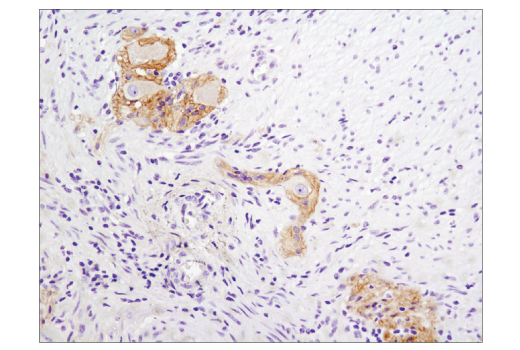 Immunohistochemistry Image 2: N-Cadherin (D4R1H) XP<sup>®</sup> Rabbit mAb (BSA and Azide Free)