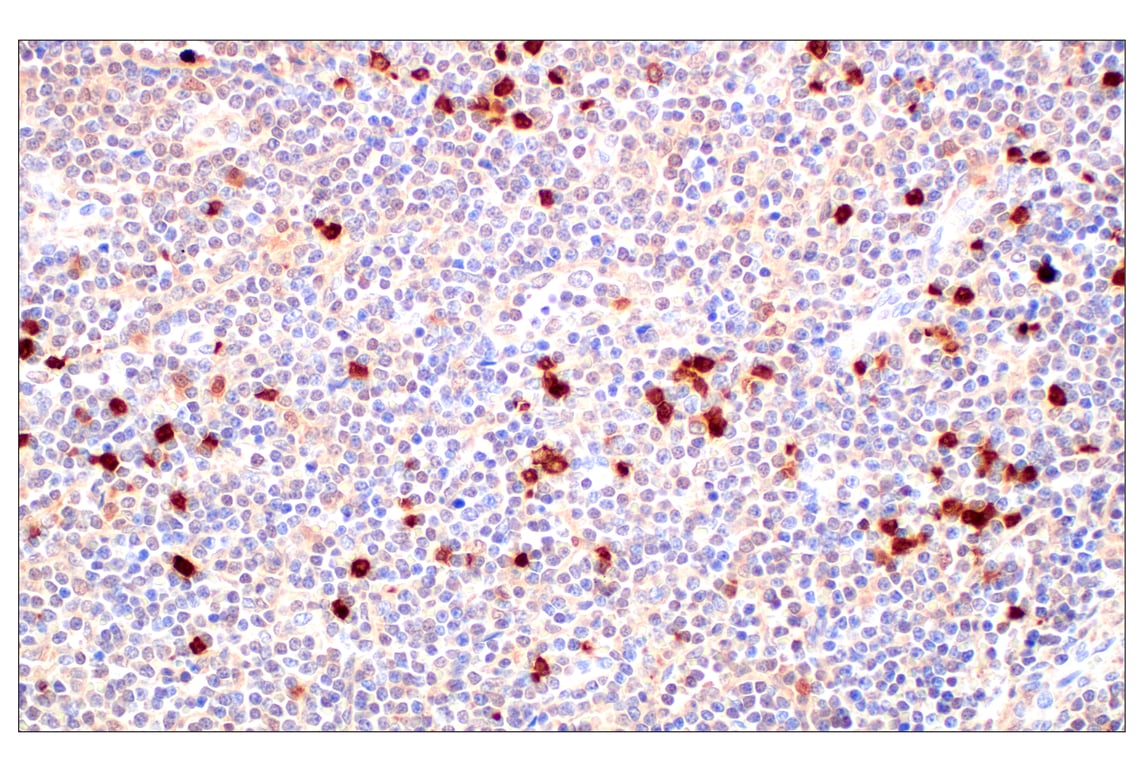Immunohistochemistry Image 1: SerpinB1 (E4W7B) Rabbit mAb