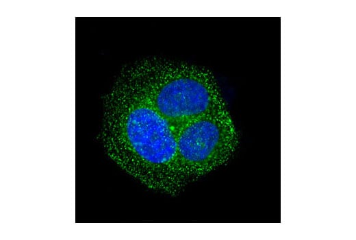 undefined Image 21: LRP1-mediated Endocytosis and Transmission of Tau Antibody Sampler Kit