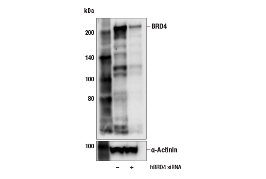 Western Blotting Image 2: BRD4 (E8V7I) Rabbit mAb