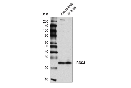 Western Blotting Image 2: RGS4 (D4V1P) Rabbit mAb