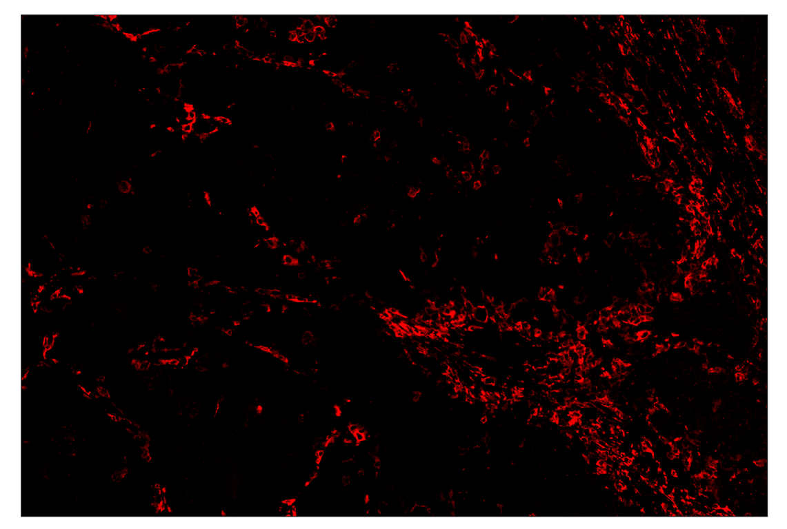 Immunohistochemistry Image 4: CD206/MRC1 (E2L9N) & CO-0035-594 SignalStar<sup>™</sup> Oligo-Antibody Pair