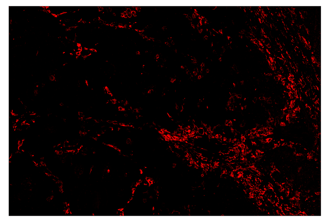 Immunohistochemistry Image 4: CD206/MRC1 (E2L9N) & CO-0035-647 SignalStar<sup>™</sup> Oligo-Antibody Pair