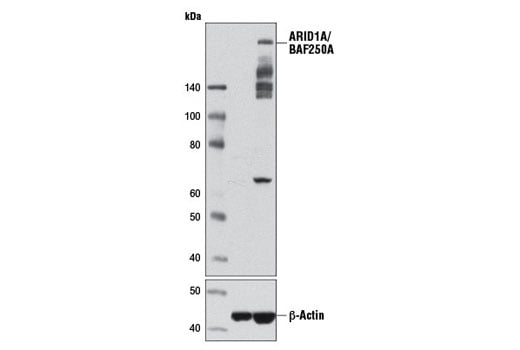 undefined Image 16: BAF Complex IHC Antibody Sampler Kit