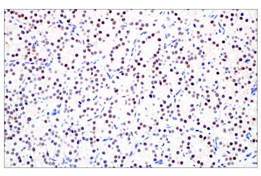 Immunohistochemistry Image 7: POU2F3 (E5N2D) XP<sup>®</sup> Rabbit mAb