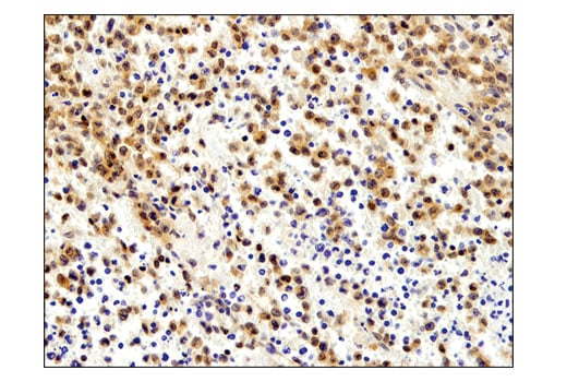 Immunohistochemistry Image 2: Akt1 (D9R8K) Rabbit mAb
