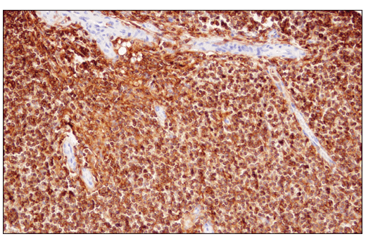 Immunohistochemistry Image 4: CD48 (D7L8I) XP<sup>®</sup> Rabbit mAb (BSA and Azide Free)