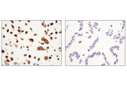 Immunohistochemistry Image 2: MMP-2 (D4M2N) Rabbit mAb