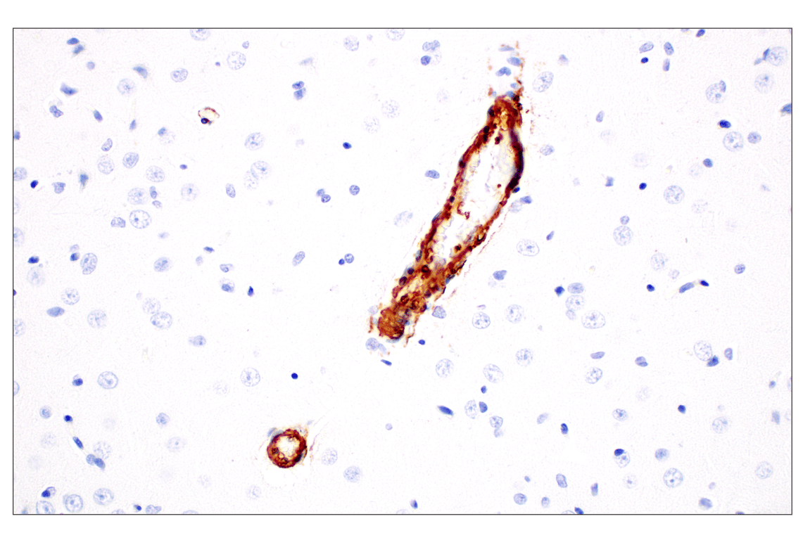 Immunohistochemistry Image 11: α-Smooth Muscle Actin (D4K9N) XP<sup>®</sup> Rabbit mAb (BSA and Azide Free)