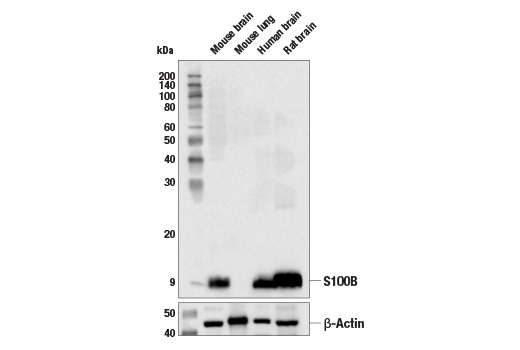 Western Blotting Image 2: S100B (E7C3A) Rabbit mAb