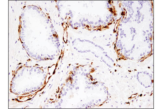 Immunohistochemistry Image 2: CD74 (D5N3I) XP<sup>®</sup> Rabbit mAb (BSA and Azide Free)