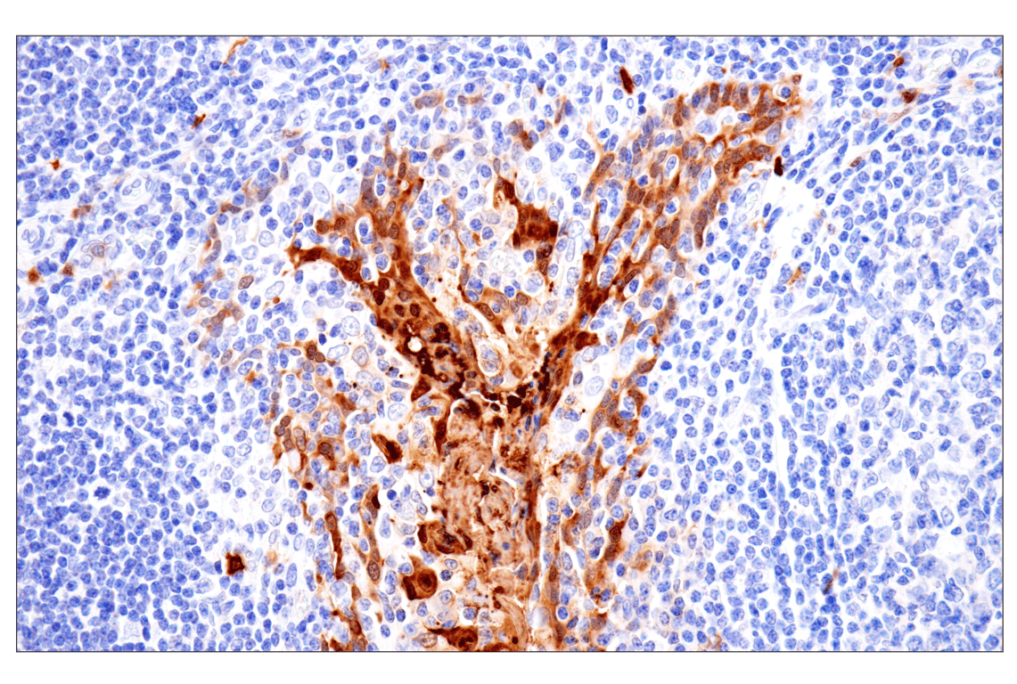 Immunohistochemistry Image 6: S100A8 (F4R2W) Rabbit mAb (BSA and Azide Free)