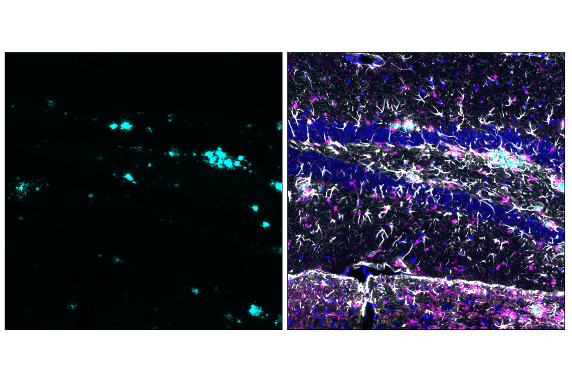 Immunofluorescence Image 2: β-Amyloid (D54D2) XP<sup>®</sup> Rabbit mAb (Alexa Fluor<sup>®</sup> 488 Conjugate)