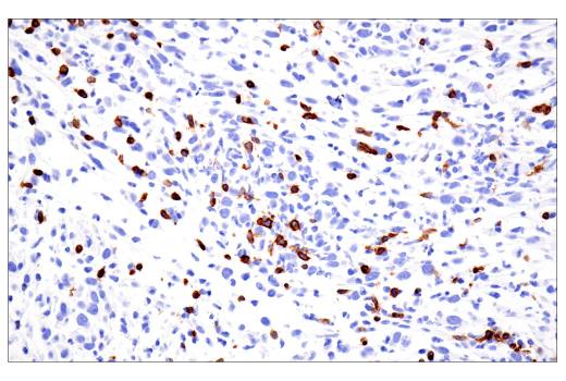 Immunohistochemistry Image 3: CD3ε (E4T1B) XP<sup>®</sup> Rabbit mAb (BSA and Azide Free)