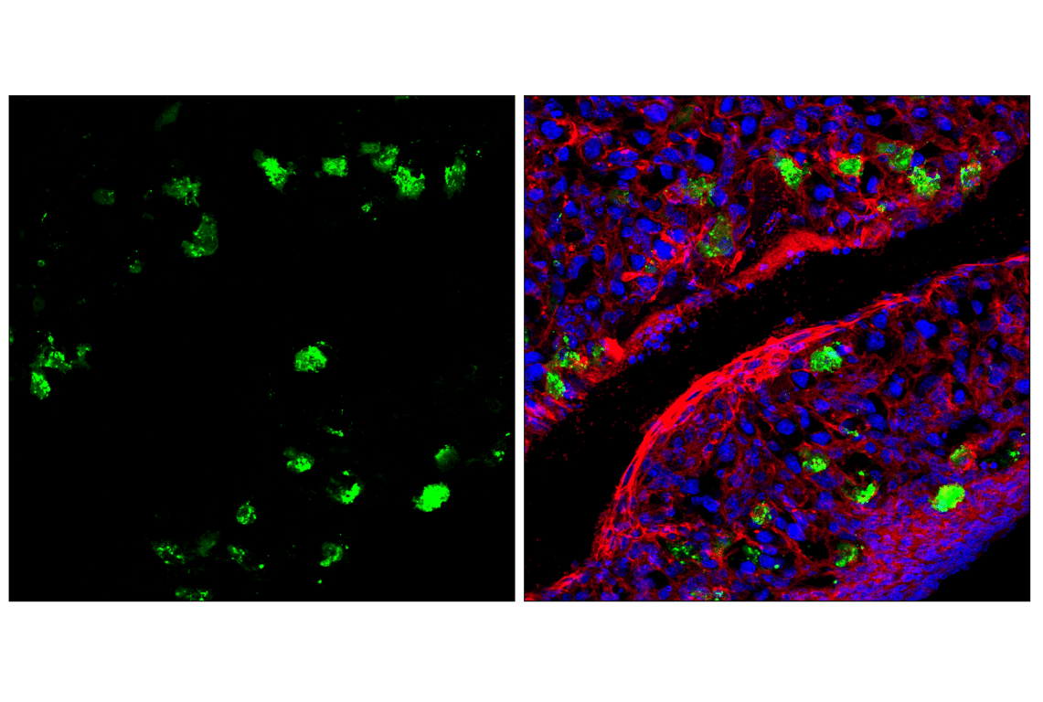 Immunofluorescence Image 1: Granzyme F (E2U7L) Rabbit mAb (Alexa Fluor<sup>®</sup> 488 Conjugate)