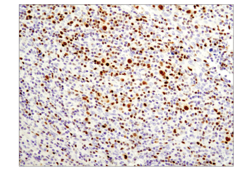 Immunohistochemistry Image 1: T-bet/TBX21 (D6N8B) XP<sup>®</sup> Rabbit mAb (BSA and Azide Free)