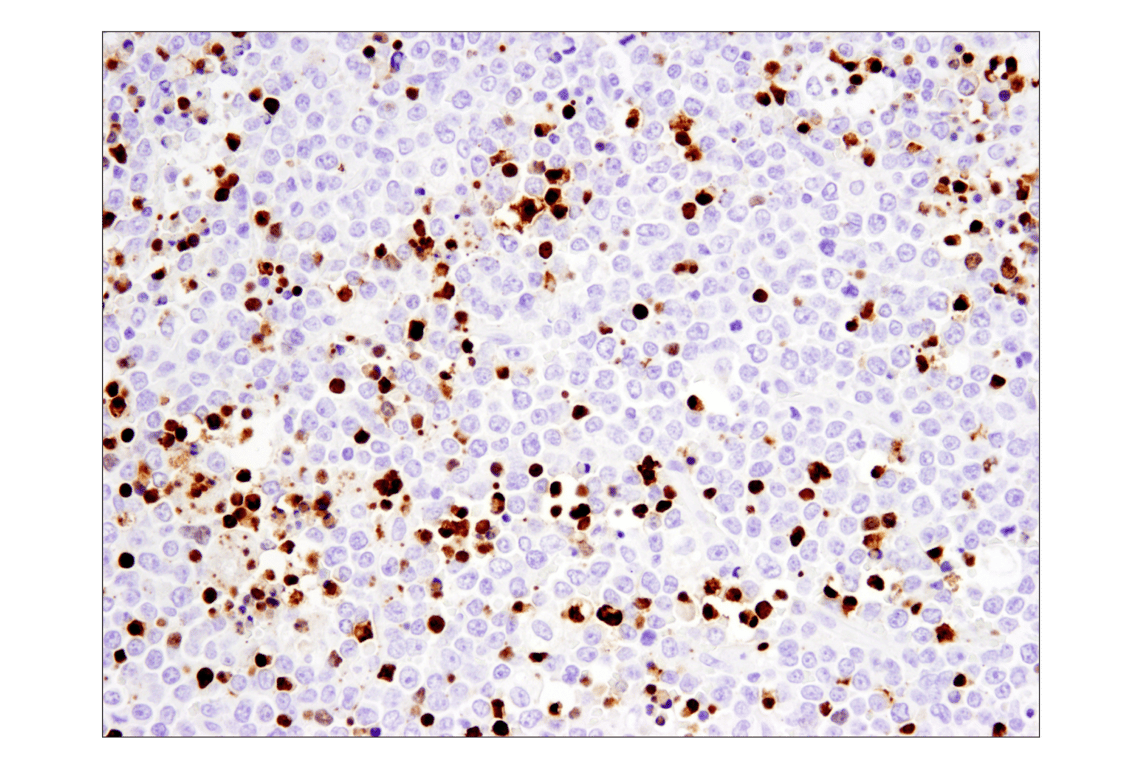 undefined Image 26: Apoptosis Antibody Sampler Kit II