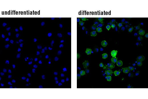 Immunofluorescence Image 1: DC-SIGN (D7F5C) XP<sup>®</sup> Rabbit mAb (BSA and Azide Free)