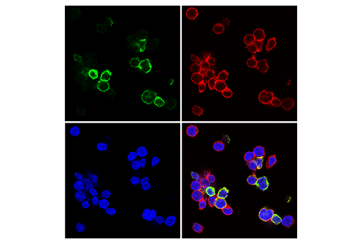 undefined Image 88: Human Exhausted CD8<sup>+</sup> T Cell IHC Antibody Sampler Kit