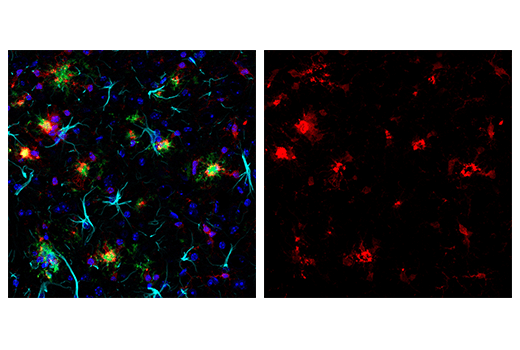 Immunofluorescence Image 1: Iba1/AIF-1 (E4O4W) XP<sup>®</sup>  Rabbit mAb (Alexa Fluor<sup>®</sup> 647 Conjugate)