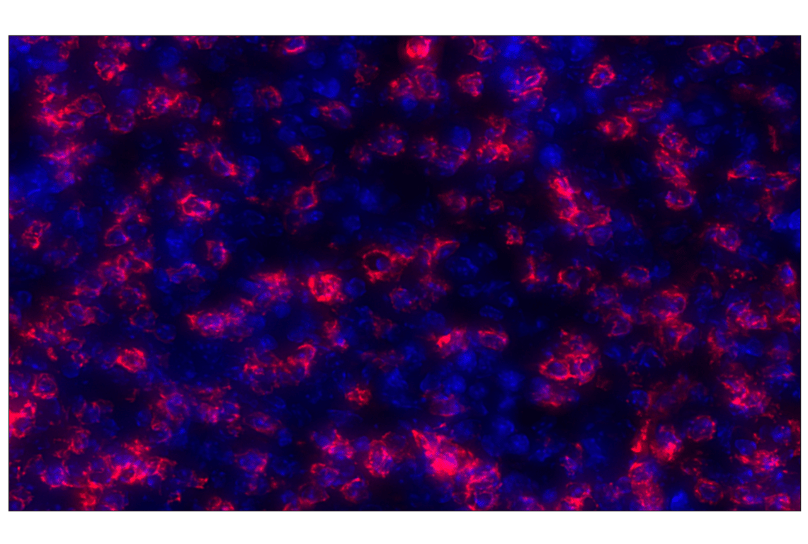 Immunohistochemistry Image 1: CD20 (E3N7O) XP<sup>®</sup> Rabbit mAb (Alexa Fluor<sup>®</sup> 647 Conjugate)