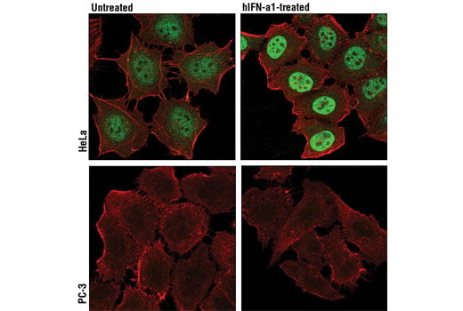 undefined Image 13: Stat3/Stat5 Signaling Antibody Sampler Kit