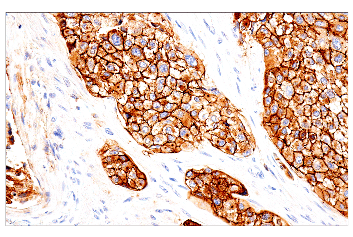 Immunohistochemistry Image 7: Syndecan 1 (E7F7T) Rabbit mAb