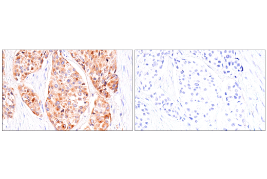 Immunohistochemistry Image 6: IGFBP3 (E6C2E) Rabbit mAb