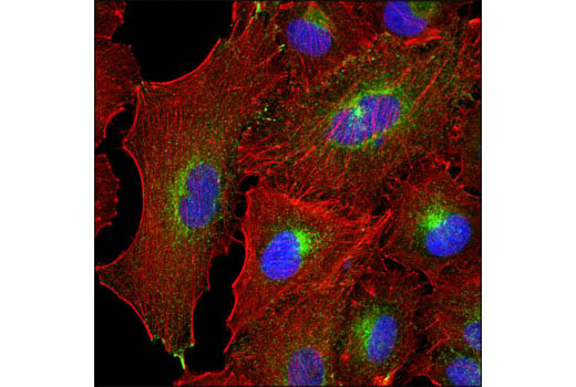 Immunofluorescence Image 1: Rab11 (D4F5) XP<sup>®</sup> Rabbit mAb