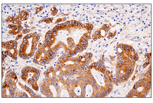 Immunohistochemistry Image 1: APP (E3F3P) Rabbit mAb